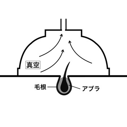 施術工程