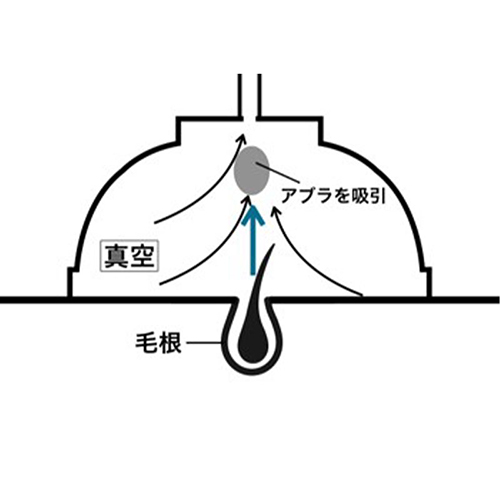 施術工程